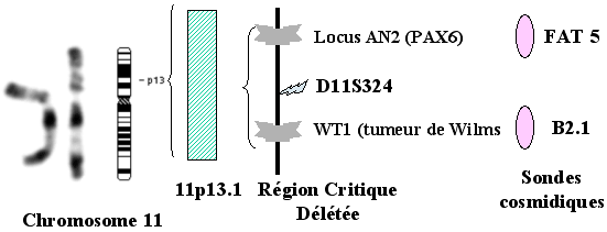 syndrome wagr