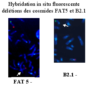 Hybridation in situ en fluorescence FISH