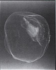 Radiographie de l'oeil de Gambetta