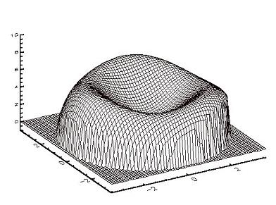 Aberration de haut grade d'un oeil myope