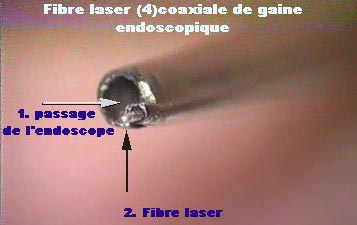 Fibre de l'endoscope oculaire