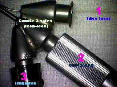 Endoscope oculaire