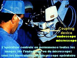 Opérateur utilisant l'endoscopie oculaire