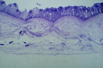 Coupe histologique d'une membrane amniotique