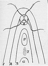 Ida Mann (Schéma des colobomes)