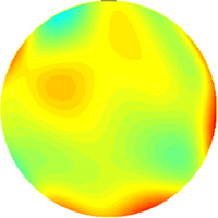 Aberrations de haut grade avant lasik