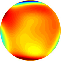 Aberrations de haut grade avant lasik