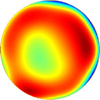 Aberrations de haut grade après lasik