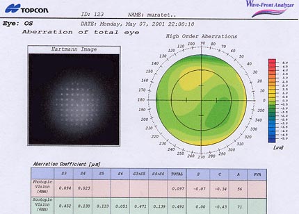 Wavefront analyzer de Topcon