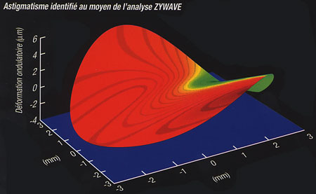 Appareil Zywave