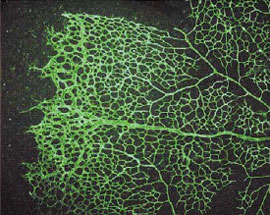 neovascularization retina