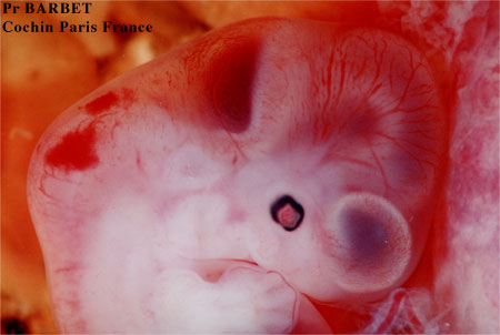 Description : Embryon de 41 jours