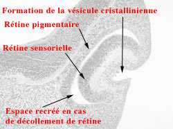 Description : Formation de la vésicule cristallinienne