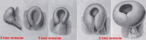 Description : Fermeture progressive de la fente colobomique