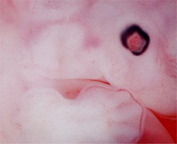 Description : Embryon de 41 jours: une main et un oeil pigmenté